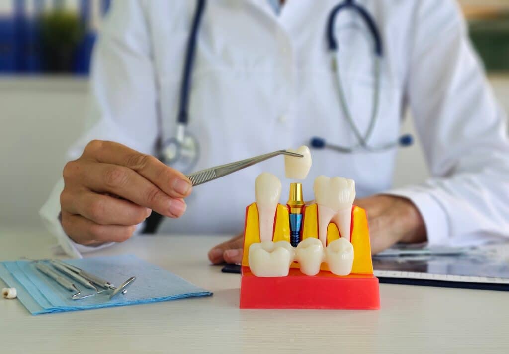 Dental Implants in Johnstown